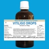 Vitiligo Drops